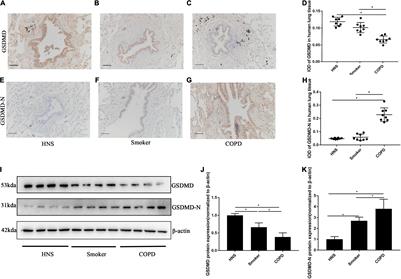 Transient Receptor Potential Cation Channel Subfamily V  - Frontiers